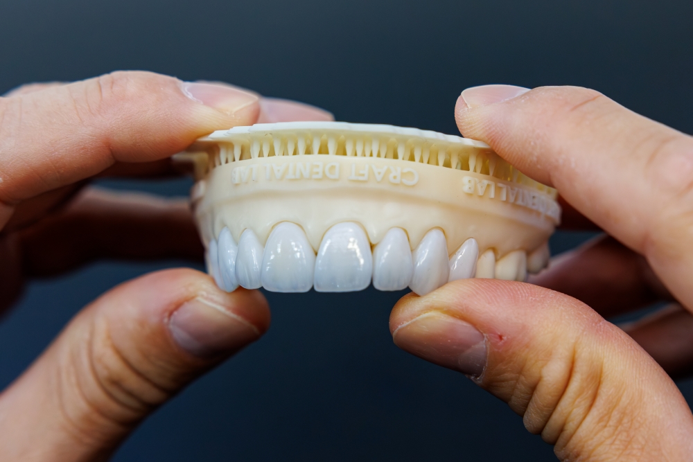 Close-up of a smile restored with porcelain veneers at Destin Implant and Smile Studio in Destin, Florida